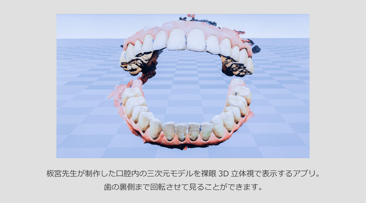 板宮先生が制作した口腔内の三次元モデルを裸眼3D立体視で表示するアプリ。歯の裏側まで回転させて見ることができます。